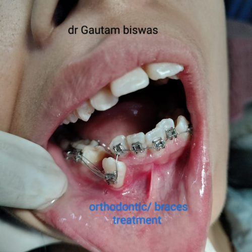 orthodontic